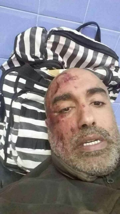 نيابة التعليم بورزازات تدخل على خط تعنيف أستاذ من طرف تلميذه