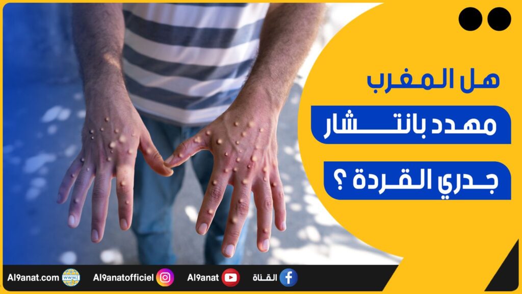 الدكتور الطيب حمضي طبيب وباحث في السياسات والنظم الصحية